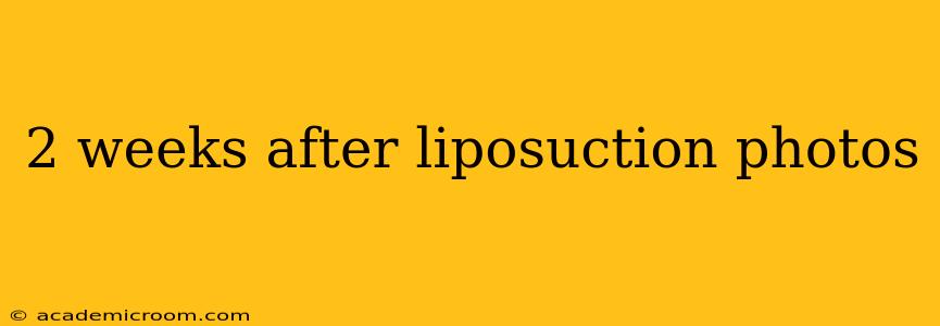 2 weeks after liposuction photos