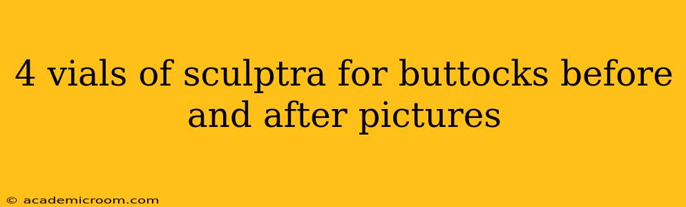 4 vials of sculptra for buttocks before and after pictures