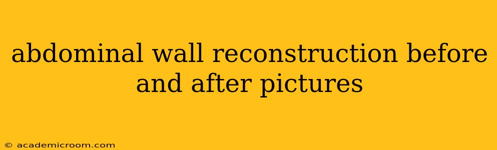 abdominal wall reconstruction before and after pictures
