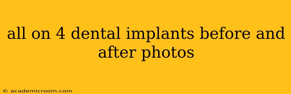 all on 4 dental implants before and after photos