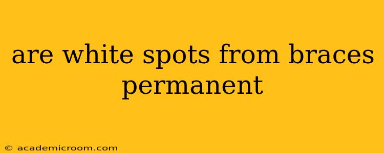 are white spots from braces permanent