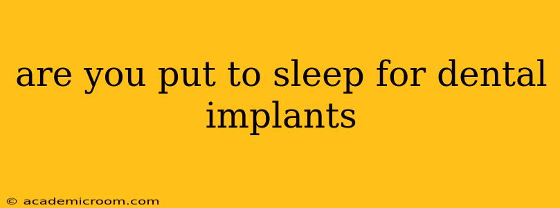 are you put to sleep for dental implants