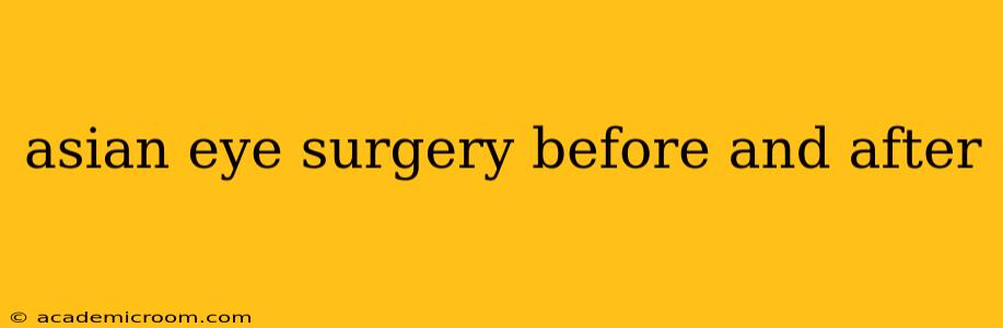 asian eye surgery before and after