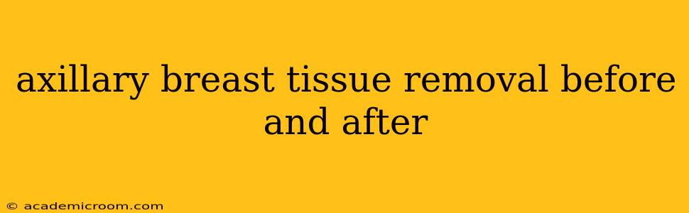 axillary breast tissue removal before and after