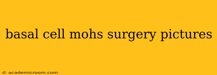 basal cell mohs surgery pictures