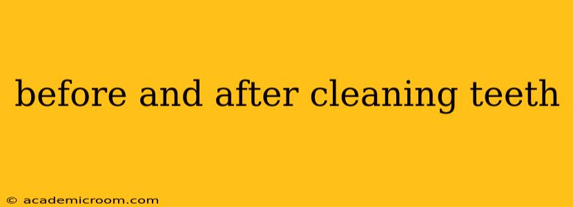 before and after cleaning teeth
