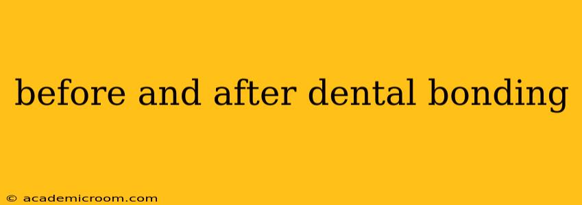 before and after dental bonding