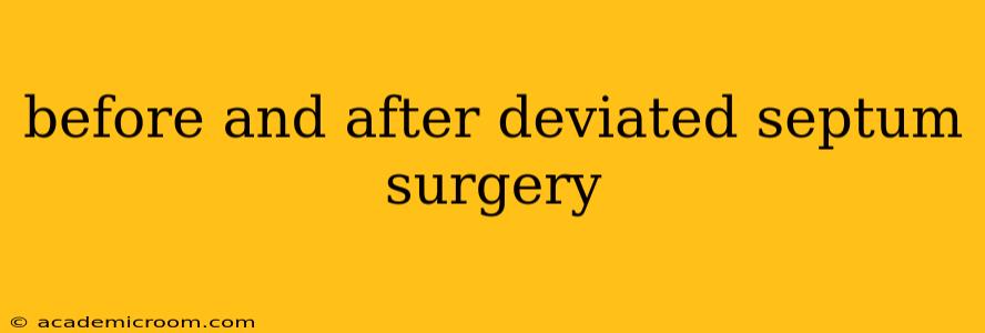 before and after deviated septum surgery
