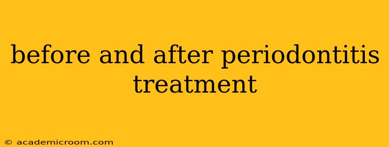 before and after periodontitis treatment