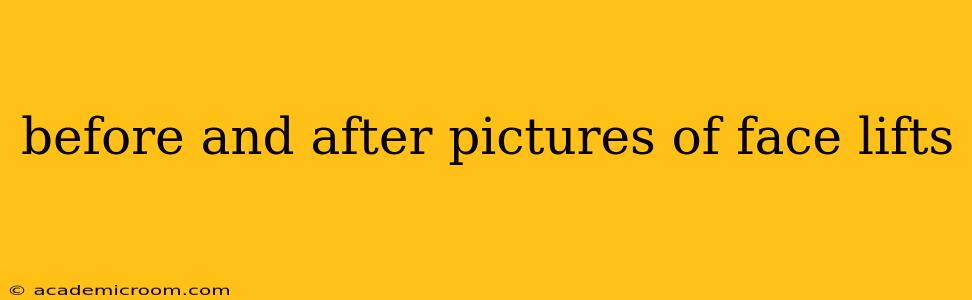 before and after pictures of face lifts