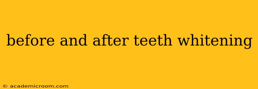 before and after teeth whitening