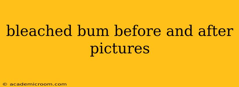 bleached bum before and after pictures