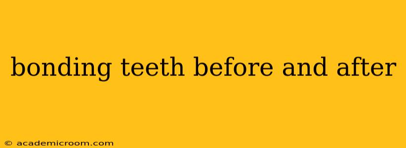 bonding teeth before and after