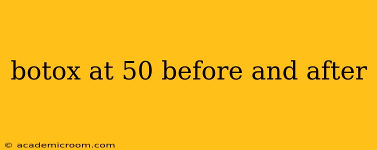 botox at 50 before and after