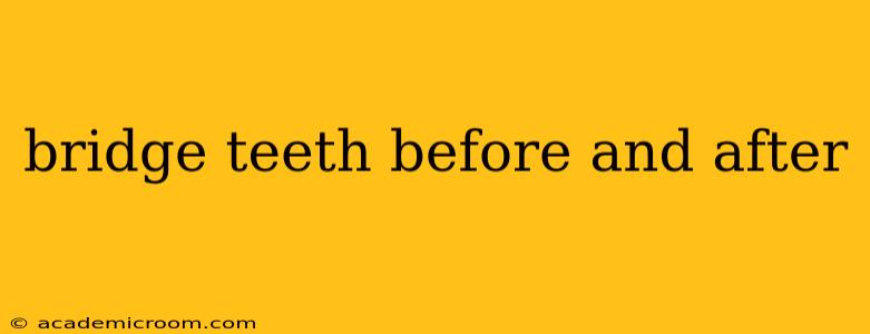 bridge teeth before and after