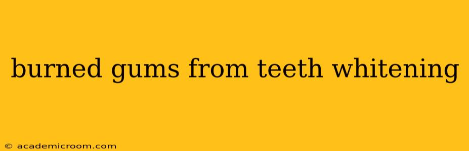 burned gums from teeth whitening