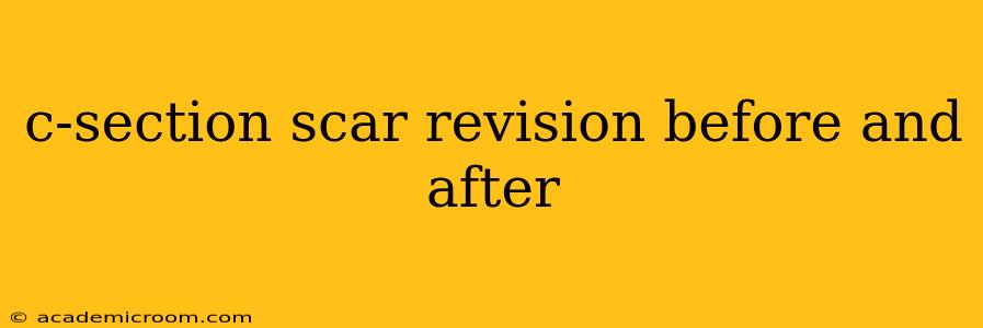 c-section scar revision before and after