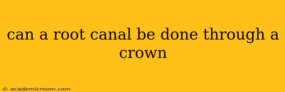 can a root canal be done through a crown