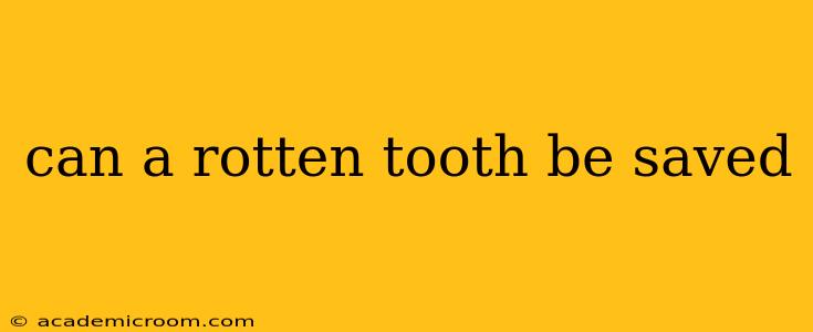 can a rotten tooth be saved