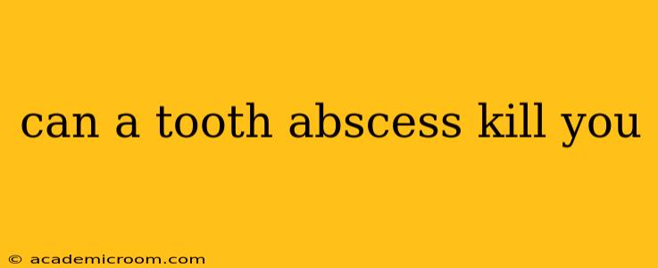 can a tooth abscess kill you
