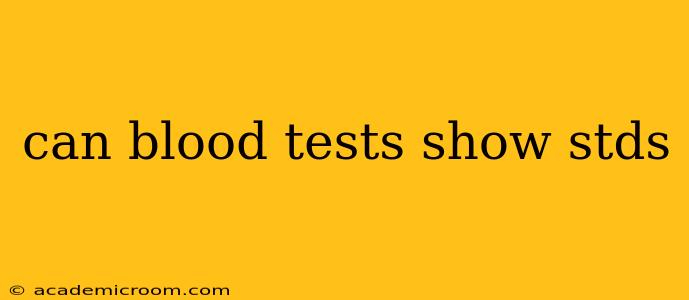 can blood tests show stds