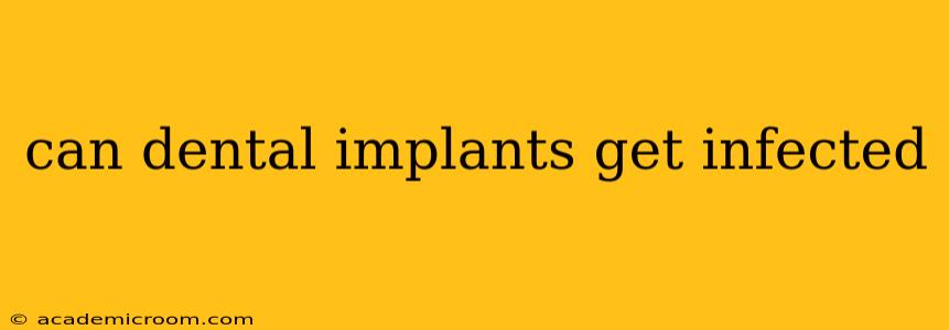 can dental implants get infected