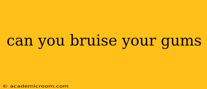 can you bruise your gums