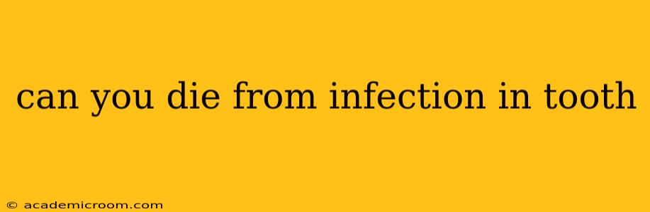 can you die from infection in tooth