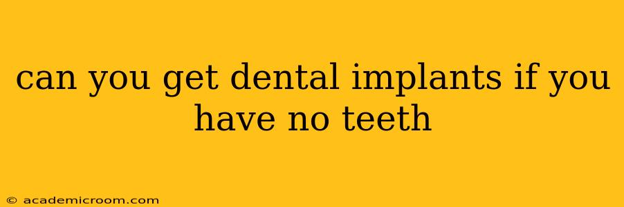 can you get dental implants if you have no teeth