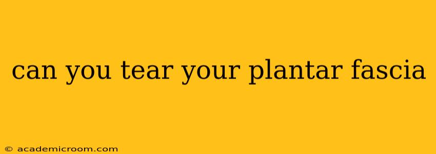 can you tear your plantar fascia