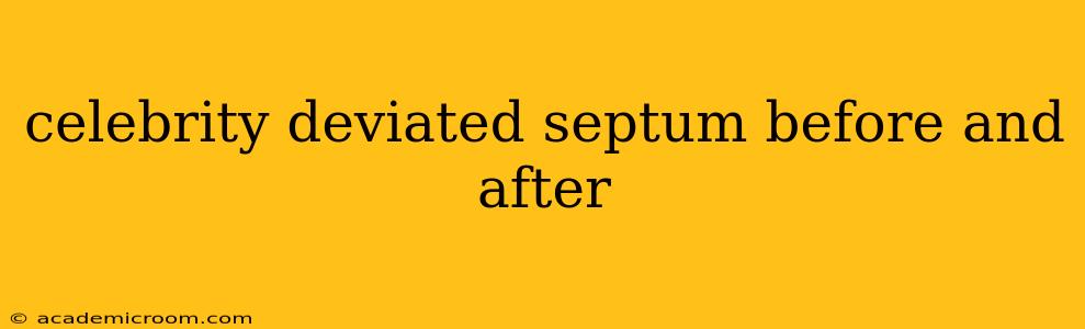celebrity deviated septum before and after
