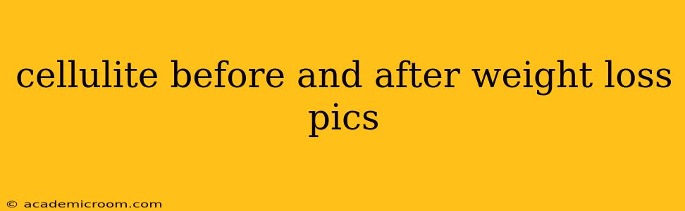 cellulite before and after weight loss pics