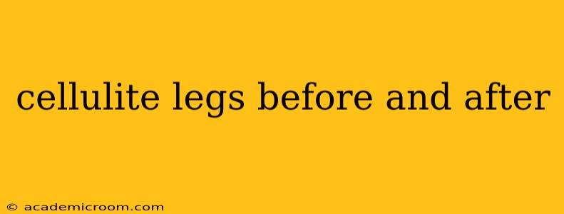 cellulite legs before and after