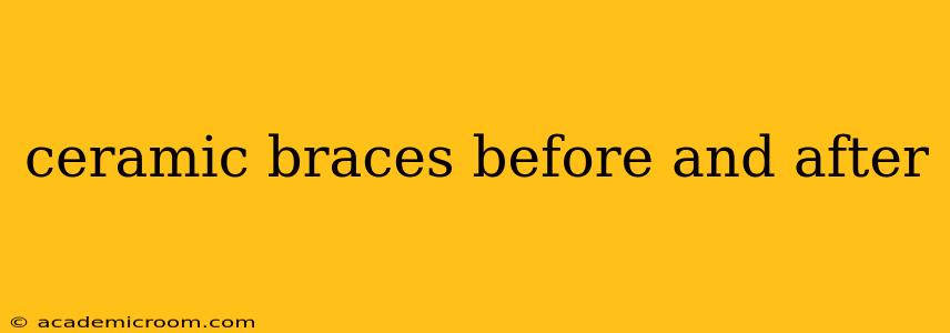 ceramic braces before and after