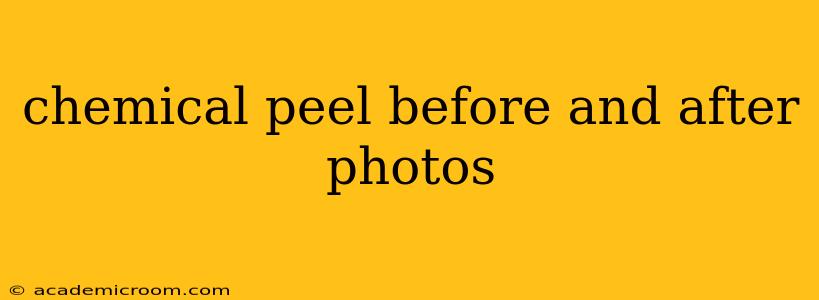 chemical peel before and after photos