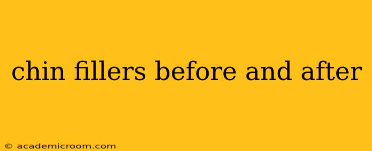 chin fillers before and after