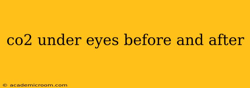 co2 under eyes before and after