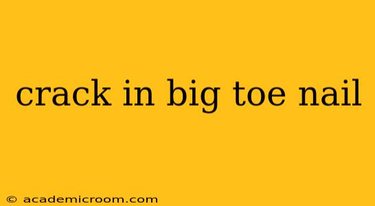 crack in big toe nail