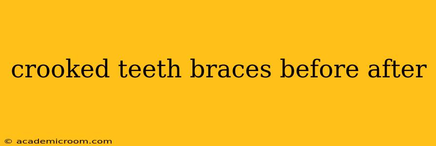 crooked teeth braces before after
