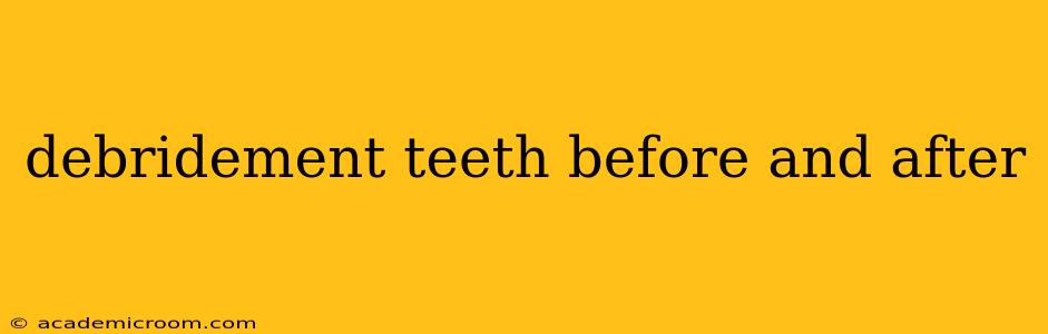 debridement teeth before and after