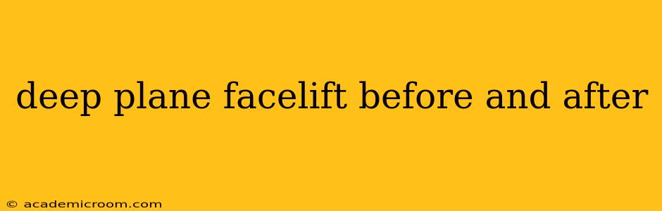 deep plane facelift before and after