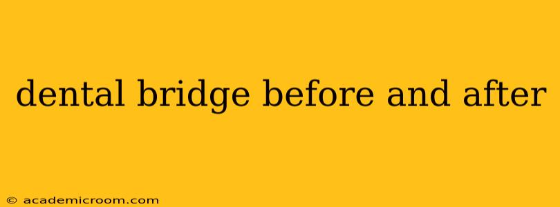 dental bridge before and after