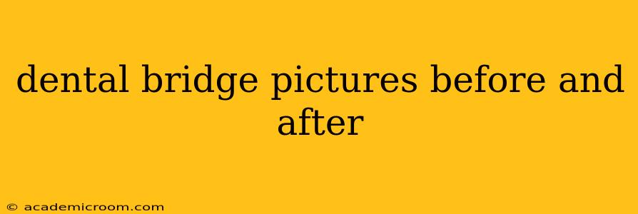 dental bridge pictures before and after