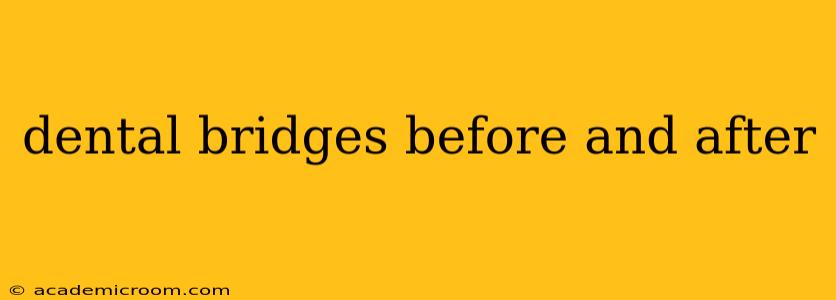 dental bridges before and after