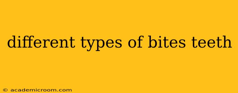 different types of bites teeth