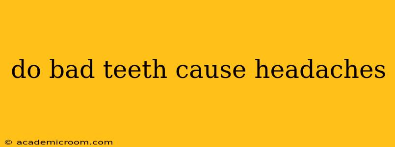 do bad teeth cause headaches