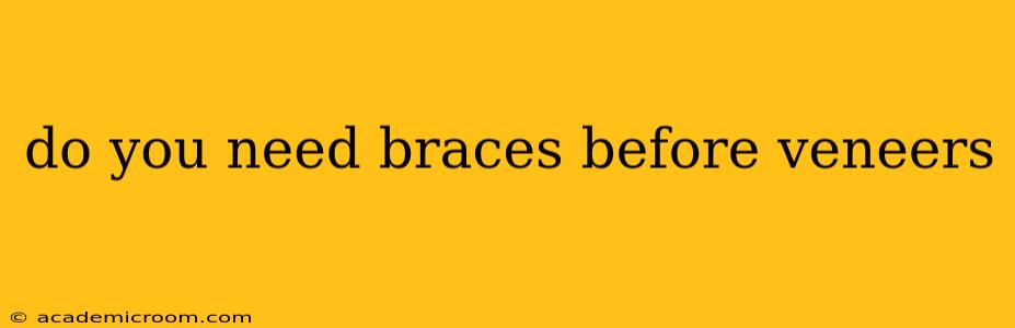 do you need braces before veneers