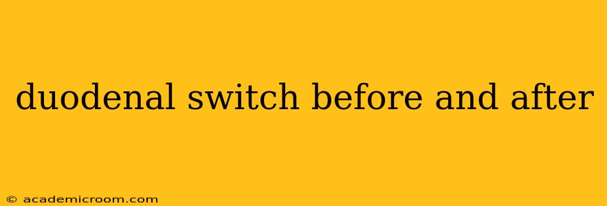 duodenal switch before and after
