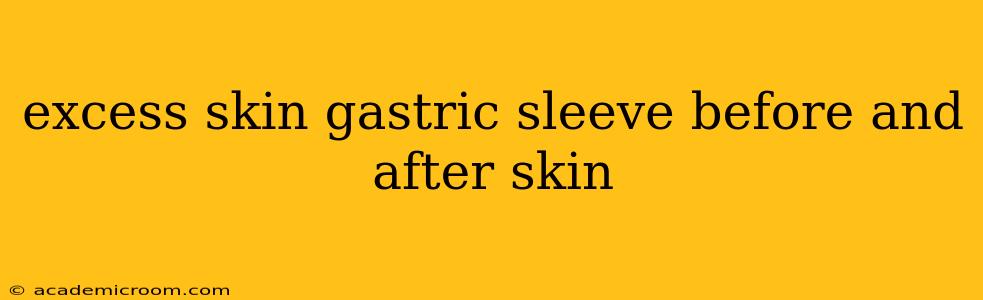 excess skin gastric sleeve before and after skin