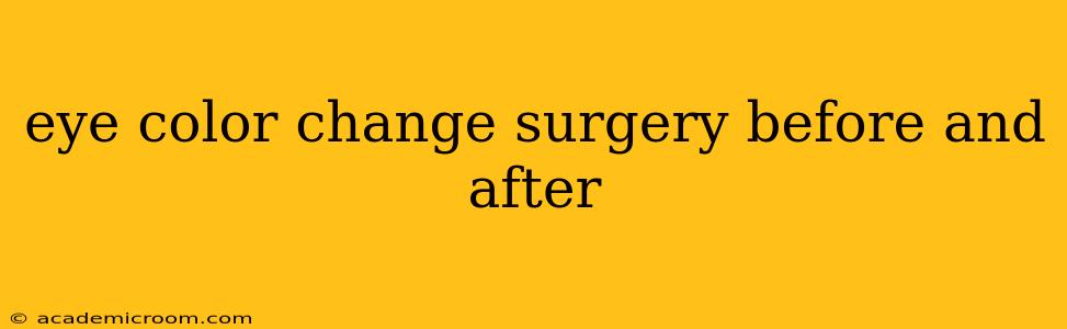 eye color change surgery before and after